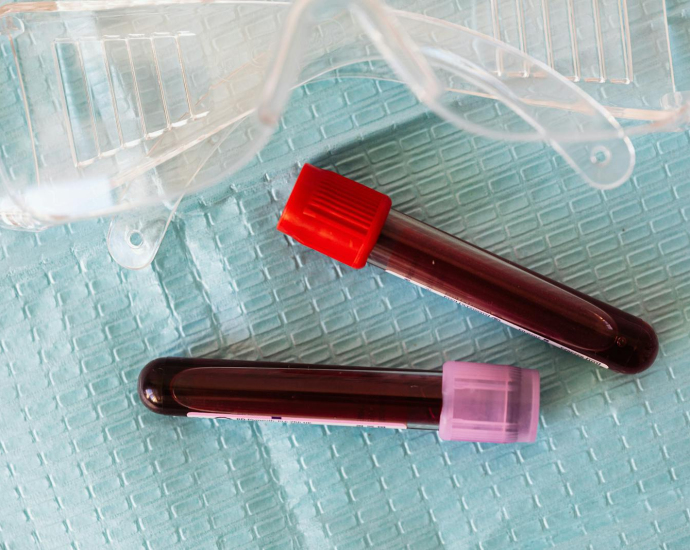 Top view closeup of protective plastic eyeglasses and full of blood vials placed on medical diaper